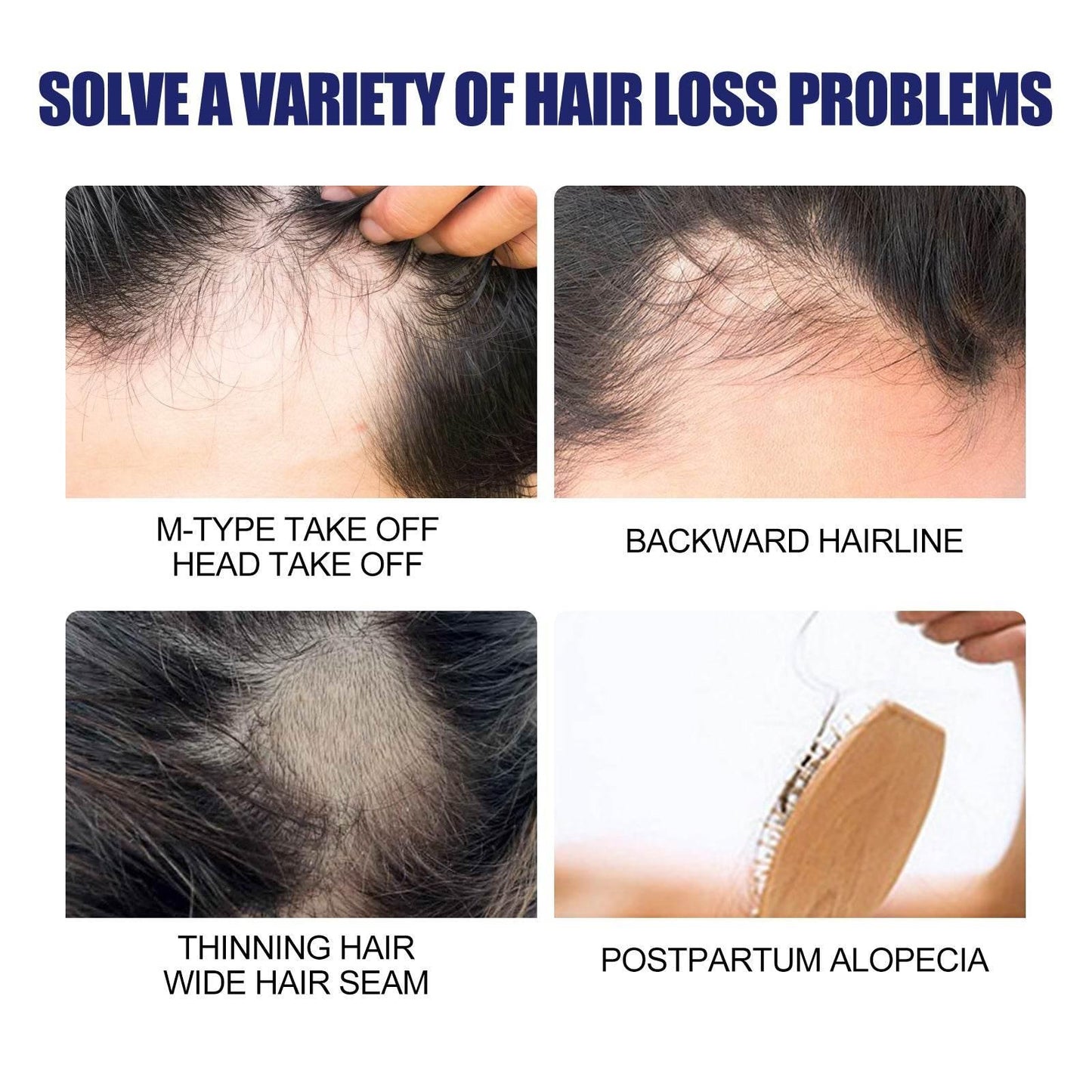 Men's Hair Thickening Foam for Root Follicle Repair - Estalios