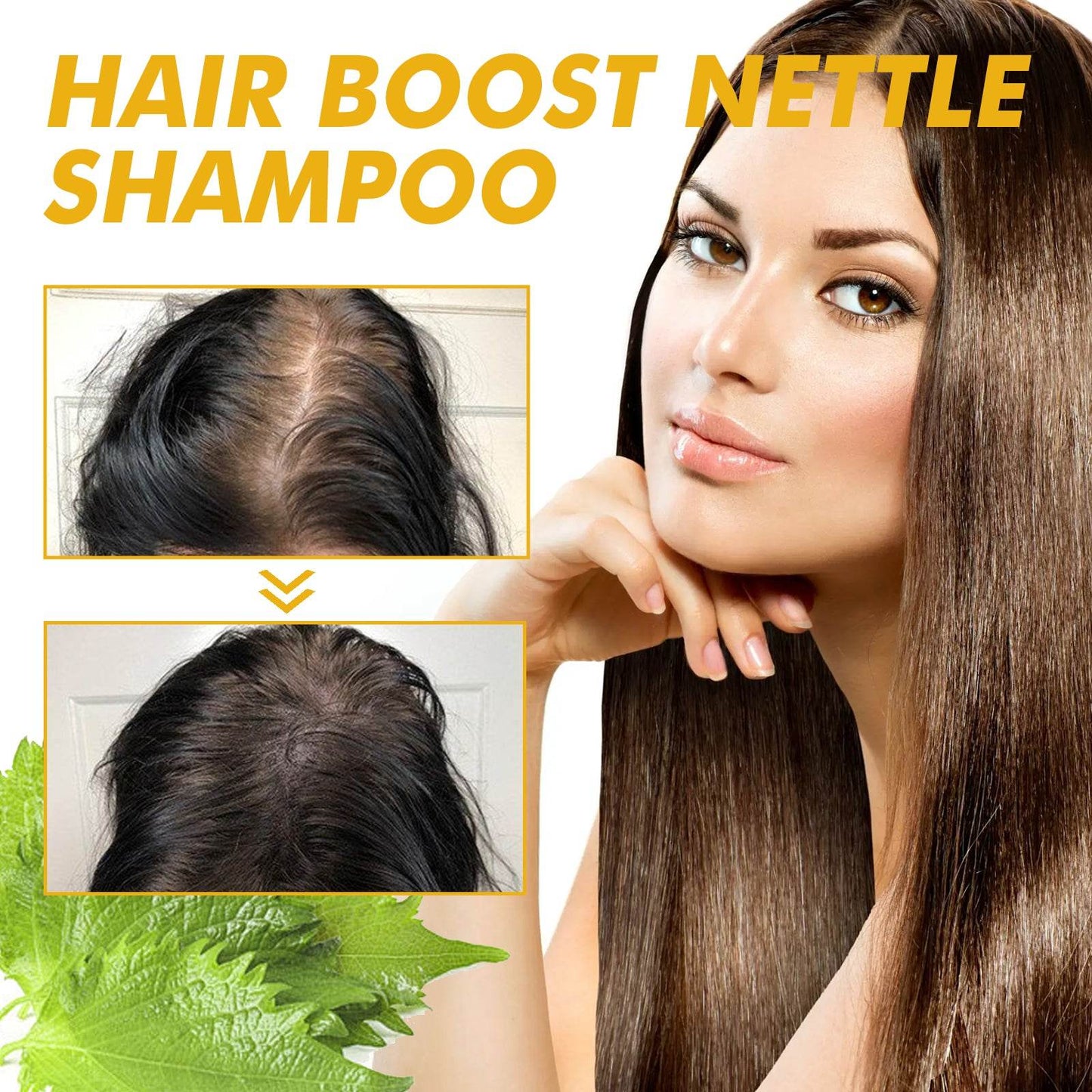 WIYUN Hair Boost Nettle Shampoo for Deep Cleansing Care - Estalios