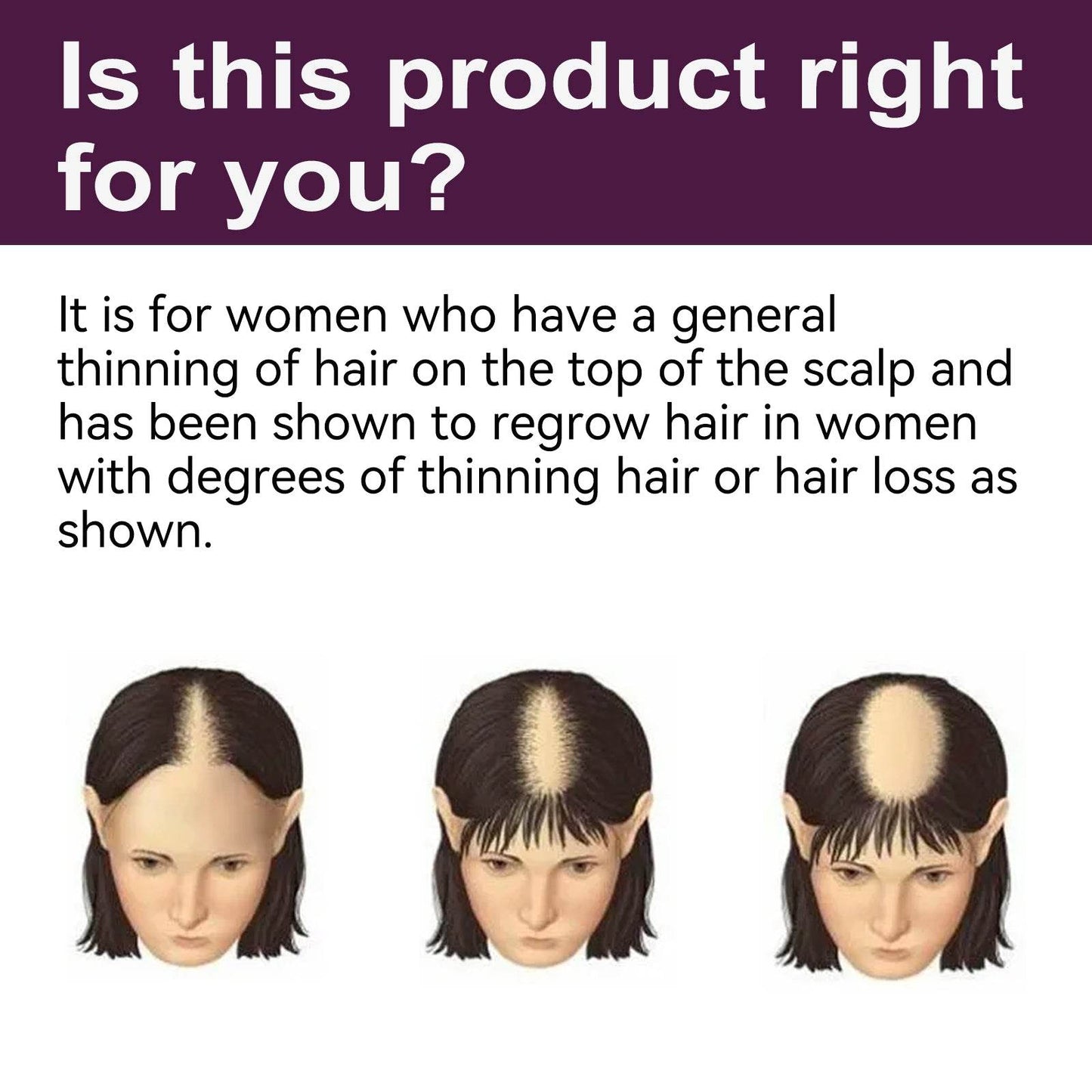 Hair Nutrition Growth Foam for Strengthening & Preventing Loss - Estalios