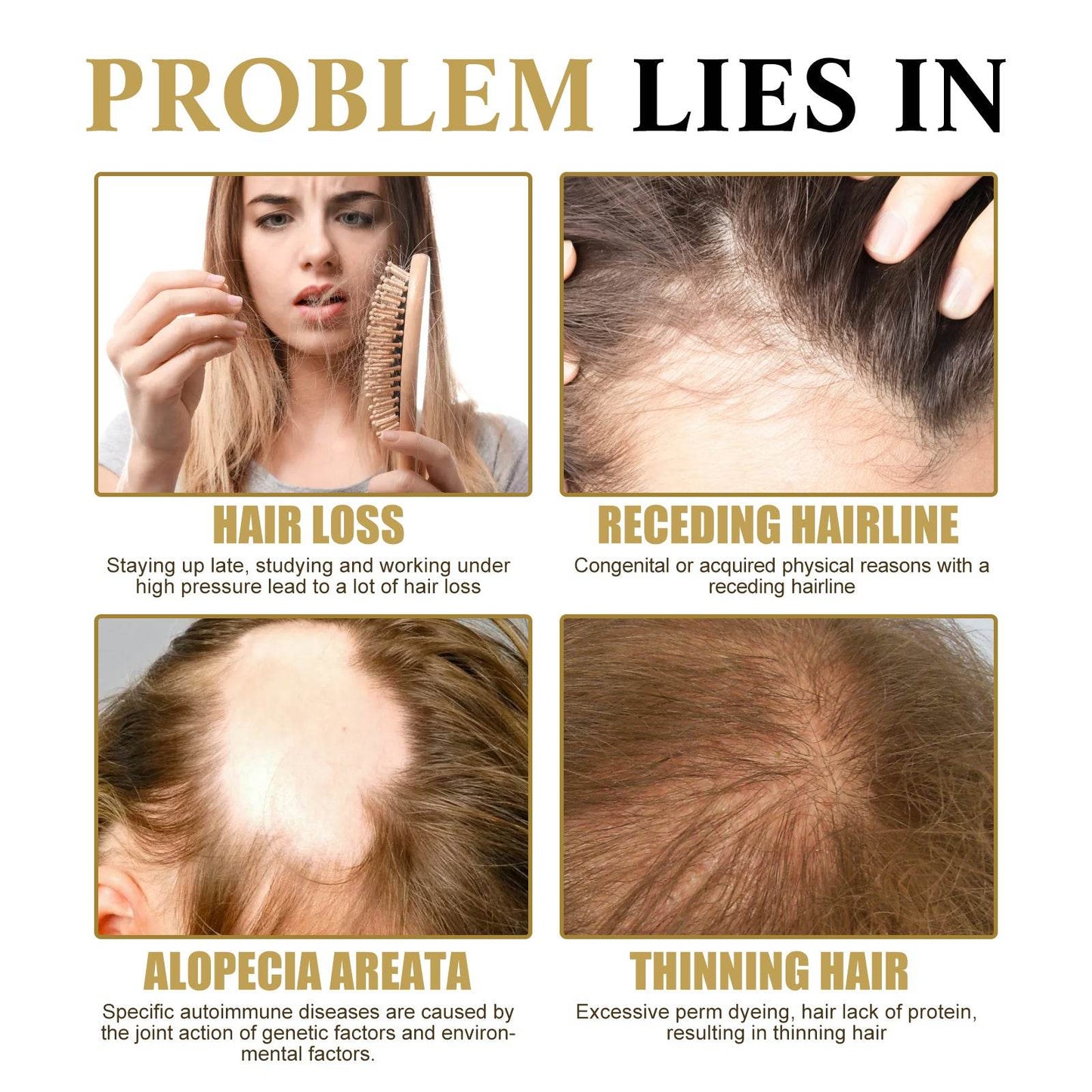 Ginseng Massage Essence Moisturizes Scalp Strengthens Hair - Estalios