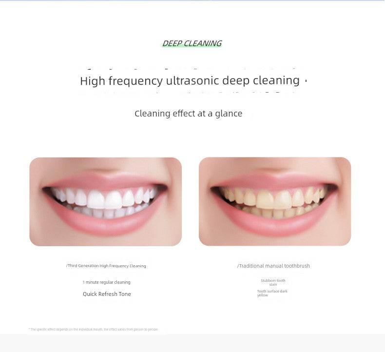 Feixiaoli Electric Toothbrush Rechargeable Soft Hair Suit - Estalios