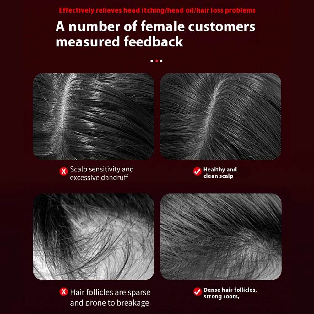 Electric Vibration Massage Comb for Hair Growth and Scalp Care - Estalios