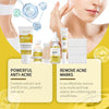 Acne Skin Care Set for Moisturizing and Soft Skin - Estalios