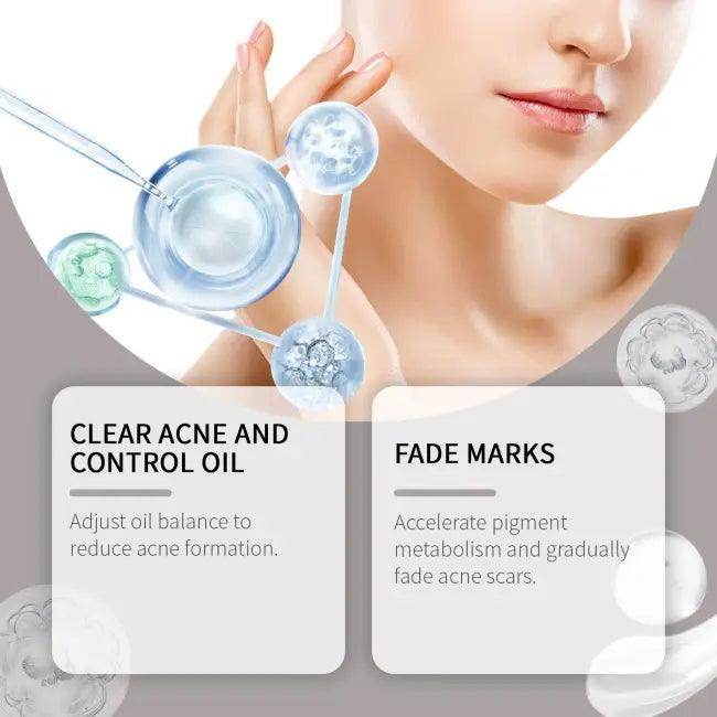 Unleash Radiant Skin With Our Acne Soothing Set - Estalios