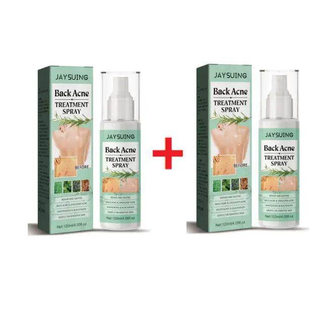 Revolutionary Acne Treatment Spray to Blast Away Back Acne - Estalios