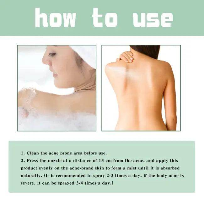 Revolutionary Acne Treatment Spray to Blast Away Back Acne - Estalios
