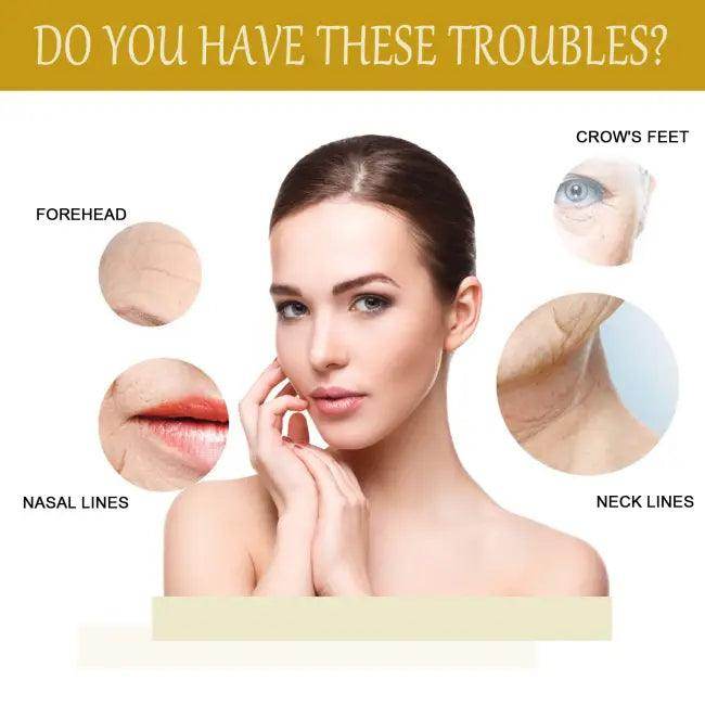 Bee Venom Essence Serum for Youthful Aging Skin - Estalios