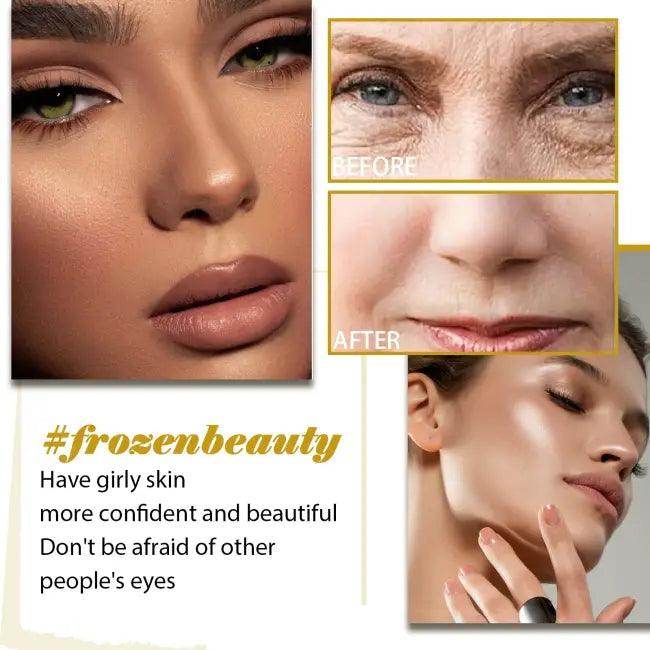 Bee Venom Essence Serum for Youthful Aging Skin - Estalios