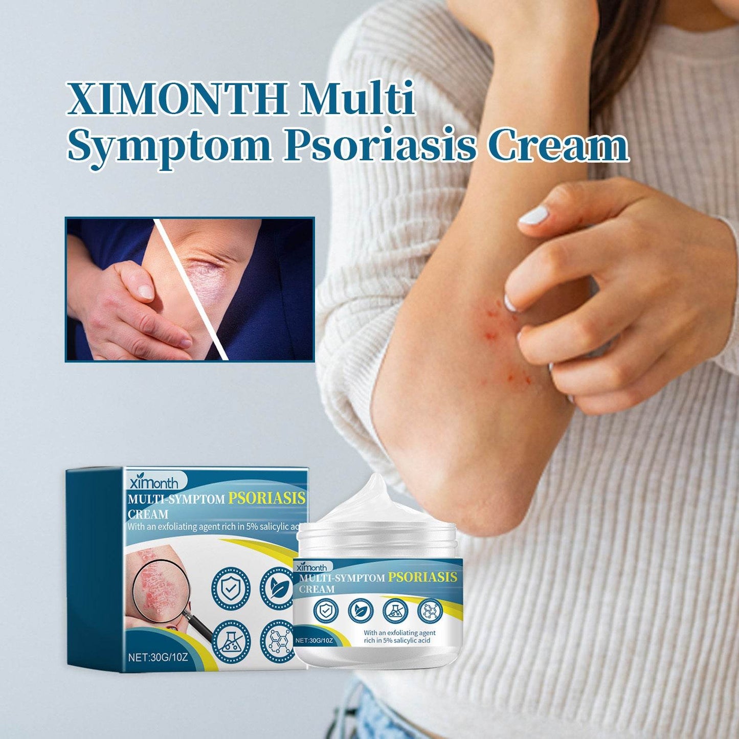 Ximonth Psoriasis Treatment Cream for Redness and Itch Relief - Estalios