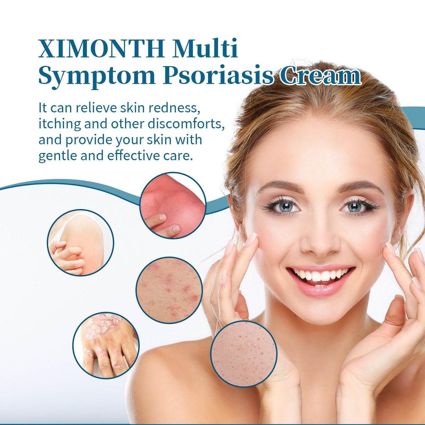 Ximonth Psoriasis Treatment Cream for Redness and Itch Relief - Estalios