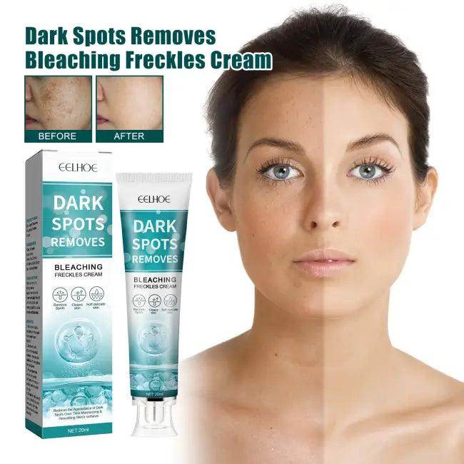 Erase Dark Spots and Unleash Your Radiant Glow Today - Estalios