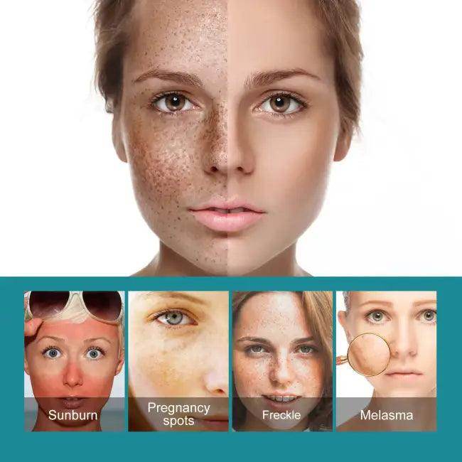 Erase Dark Spots and Unleash Your Radiant Glow Today - Estalios