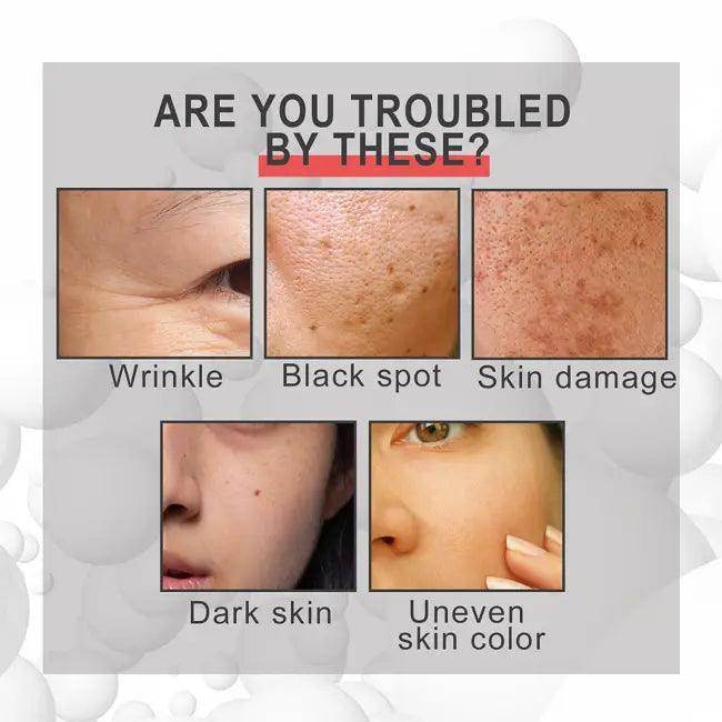 EELHOE Face Lightening Cream for Youthful Flawless Skin - Estalios