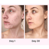 Face Massager Anti Wrinkles for Youthful Radiance - Estalios