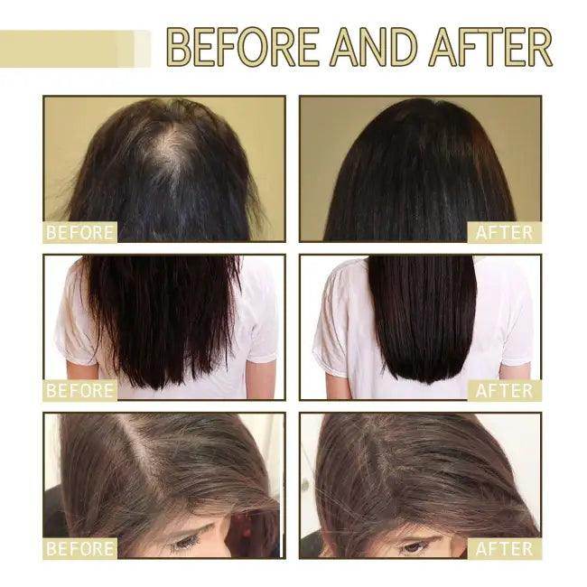 Hair Boost Oil for Dense Hair Growth and Nourishment - Estalios