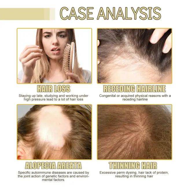 Hair Boost Oil for Dense Hair Growth and Nourishment - Estalios