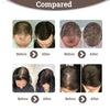 Hair Enhancement Spray Anti-Loss Treatment for Strong Hair - Estalios