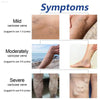 Heating Leg Cover for Blood Circulation and Lymphatic Relief - Estalios