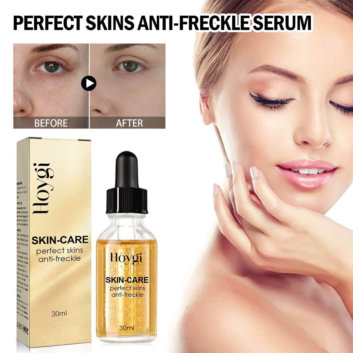 Freckle Fade: Unleash Your Flawless Radiance - Estalios