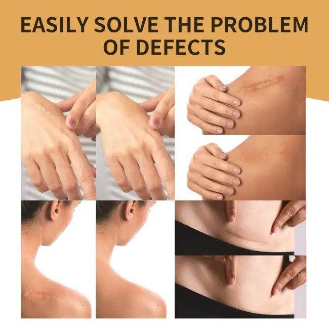 Jaysuing Invisible Concealer for Scar and Tattoo Coverage Magic - Estalios