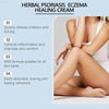 Eczema Psoriasis Vanish with Laniska Skin Soothing Repair Cream - Estalios