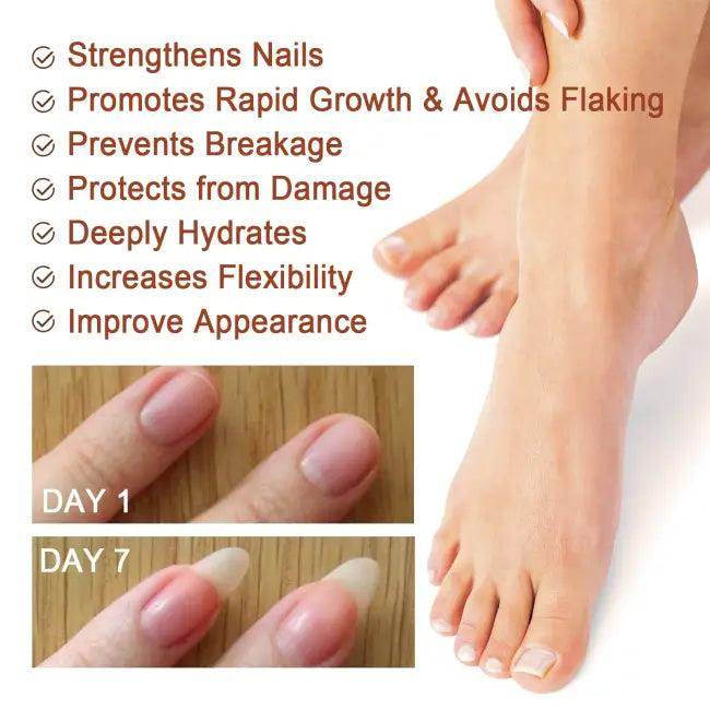Nail Repair Serum with Dropper for Quick Nail Recovery - Estalios