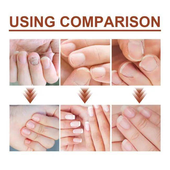 Nail Repair Serum with Dropper for Quick Nail Recovery - Estalios