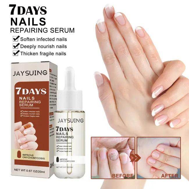 Nail Repair Serum with Dropper for Quick Nail Recovery - Estalios
