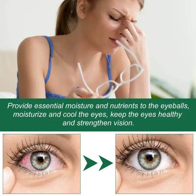 Presbyopia Eye Drops for Dry, Itchy Eye Relief - Estalios