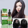 Rosemary Hair Essential Oil for Gentle Scalp Care - Estalios