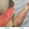 Soothing Eczema Relief Pack - Estalios