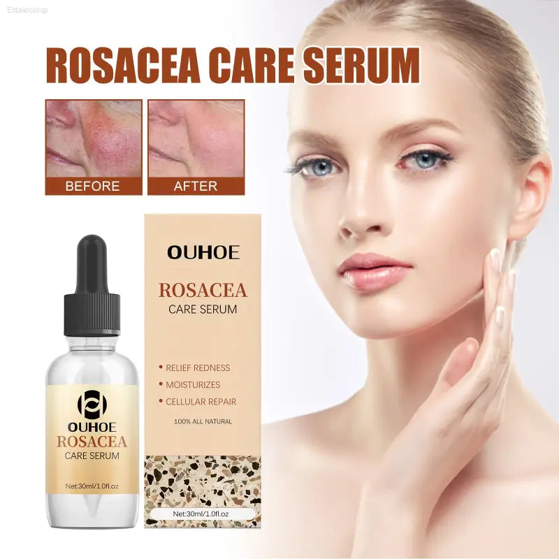 ✨ Soothing Repair – Erythematous Repair Essence | Hydrating and Strengthening Serum for Sensitive Skin - default title