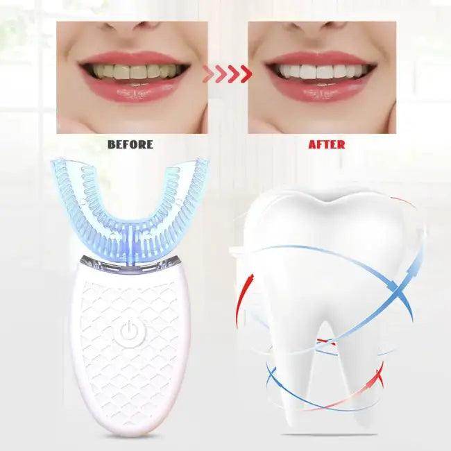 U-Shaped Smile Booster Electric Toothbrush for Bright Smiles - Estalios