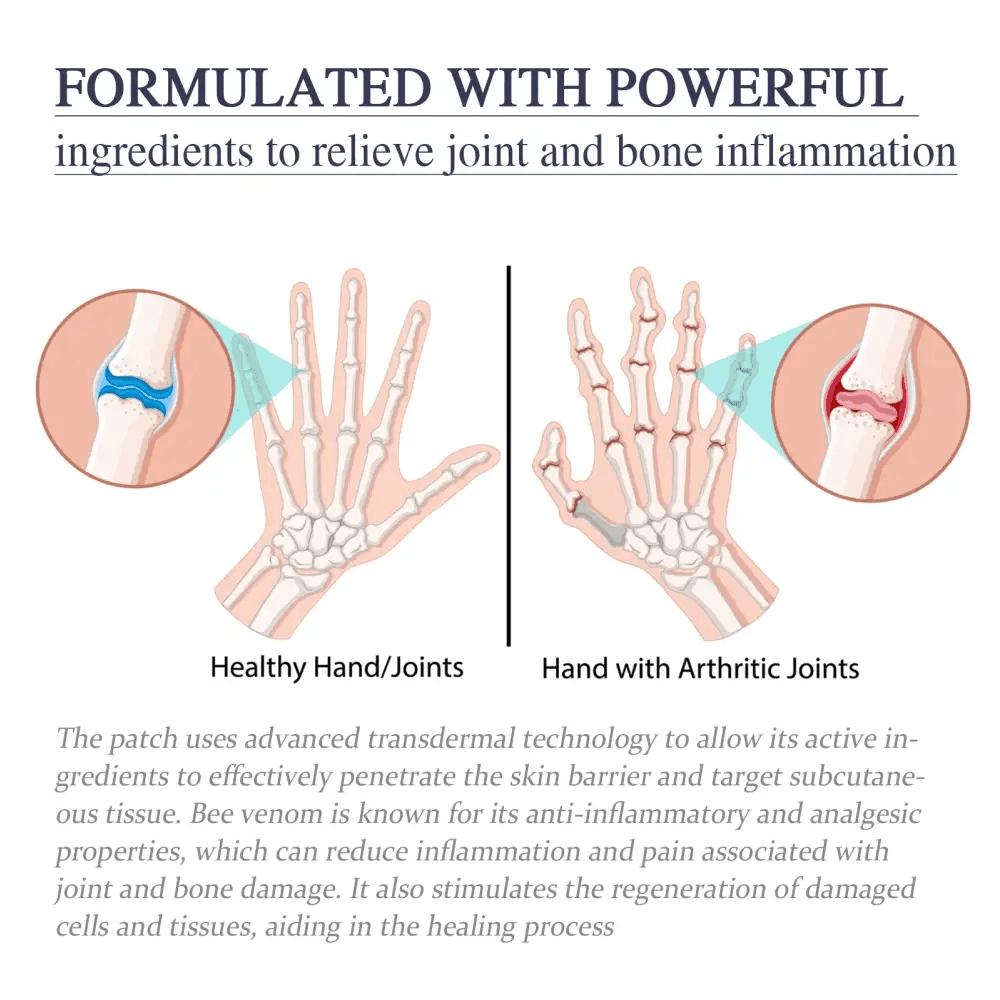 Ximonth Bee Venom Joint Cream for Effective Pain Relief - Estalios