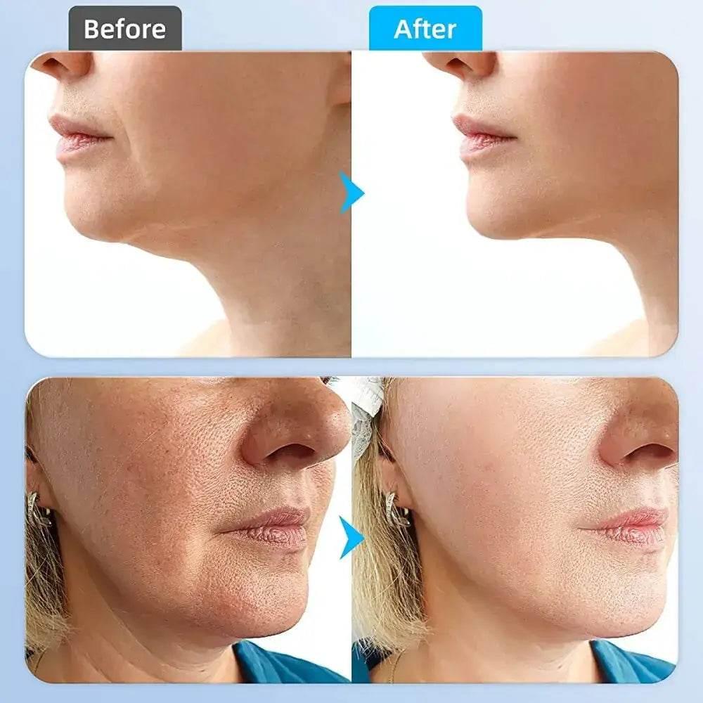 YouthBoost Microcurrent Facial Toner for Radiant Skin - Estalios