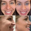 Youthful Glue-Free Lift Patches – Say Goodbye to Fine Lines! Wind Beauty Store EstaliosShop