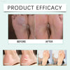 10pcs High Heels Gel Blister Bandages for Foot Protection - Estalios