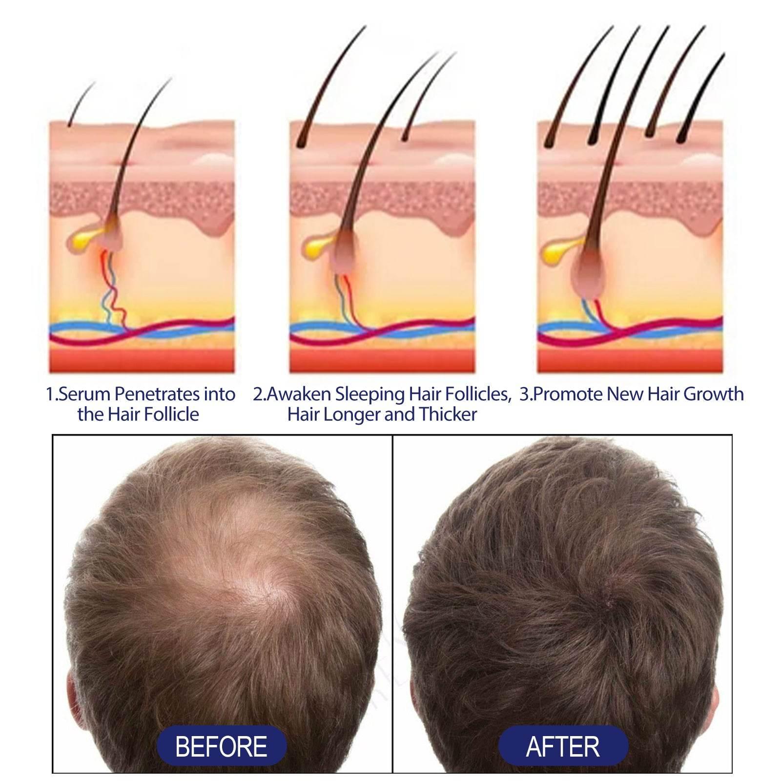 Men's Hair Thickening Foam for Root Follicle Repair - Estalios