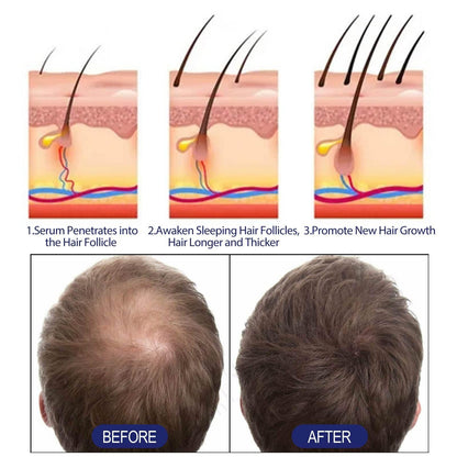 Men's Hair Thickening Foam for Root Follicle Repair - Estalios