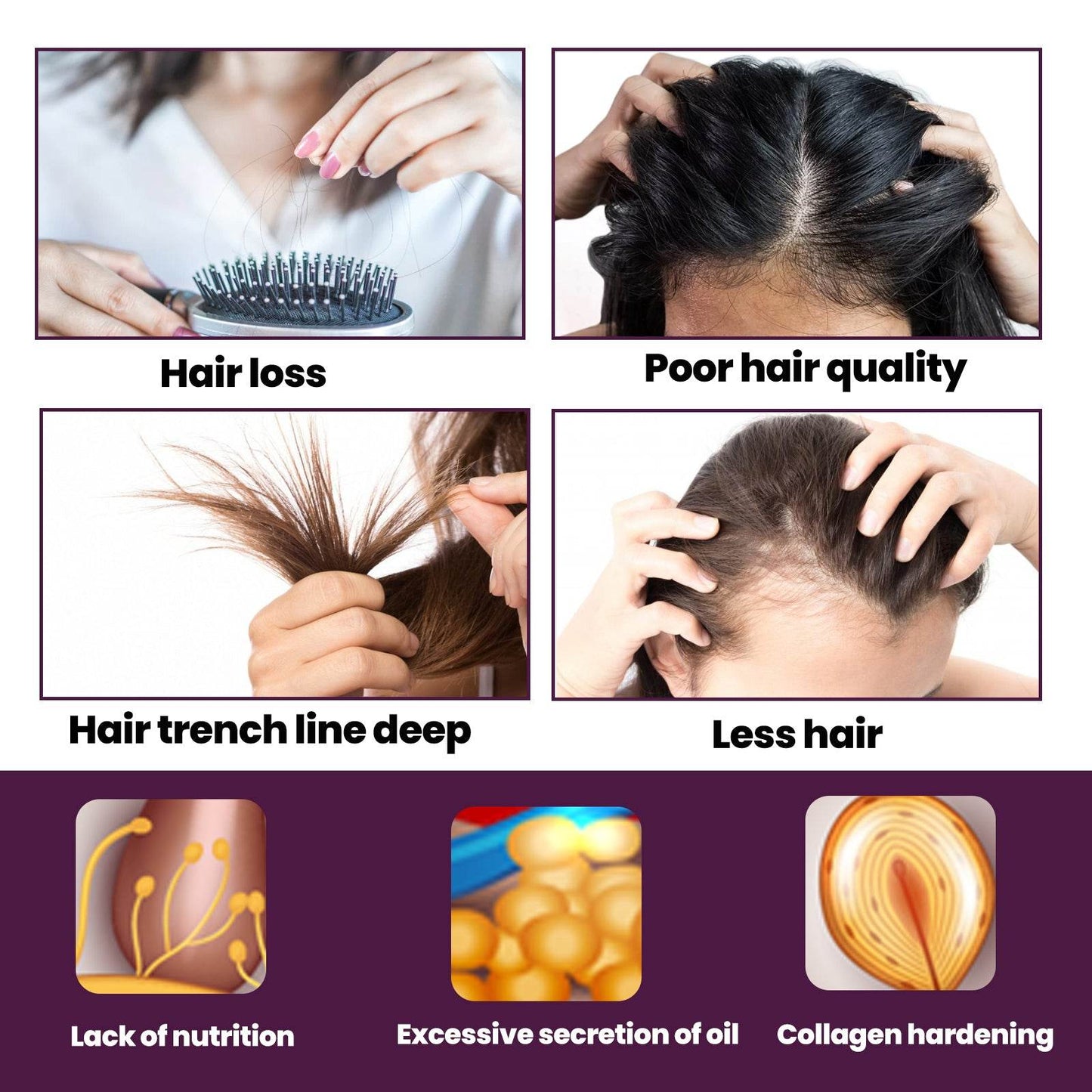 Hair Nutrition Growth Foam for Strengthening & Preventing Loss - Estalios