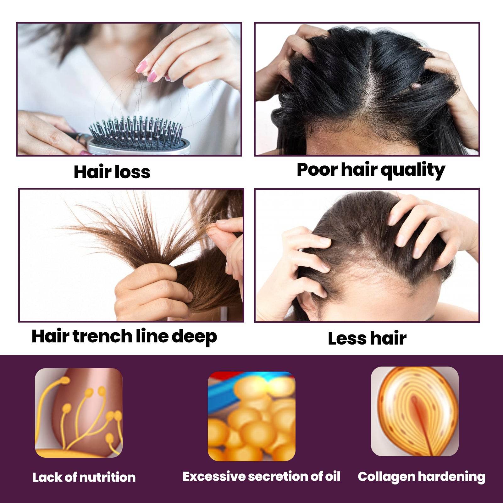 Hair Nutrition Growth Foam for Strengthening & Preventing Loss - Estalios