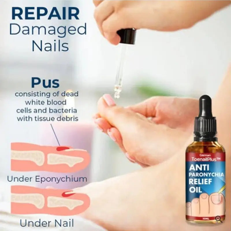 Bright Nail Repair Thickened Nail Groove Treatment Oil