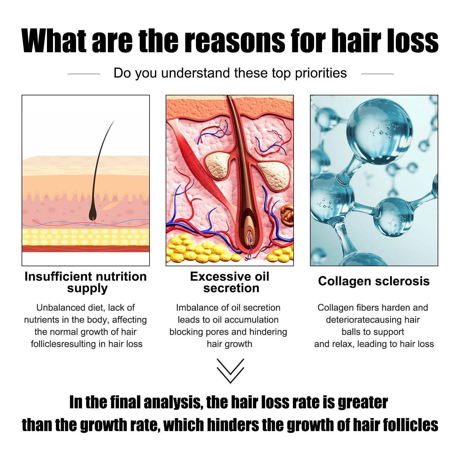 Men's Dense Hair Essence for Strengthening and Nourishing Hair - Estalios