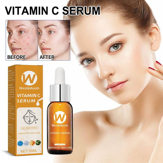 Facial Treatment Essence for Acne Marks and Oil Control - Estalios