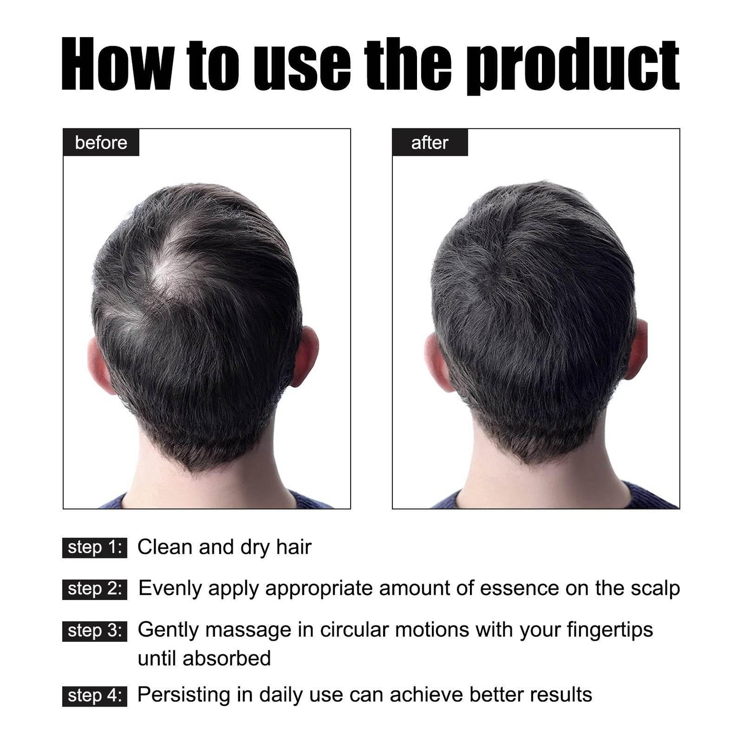 Men's Dense Hair Essence for Strengthening and Nourishing Hair - Estalios