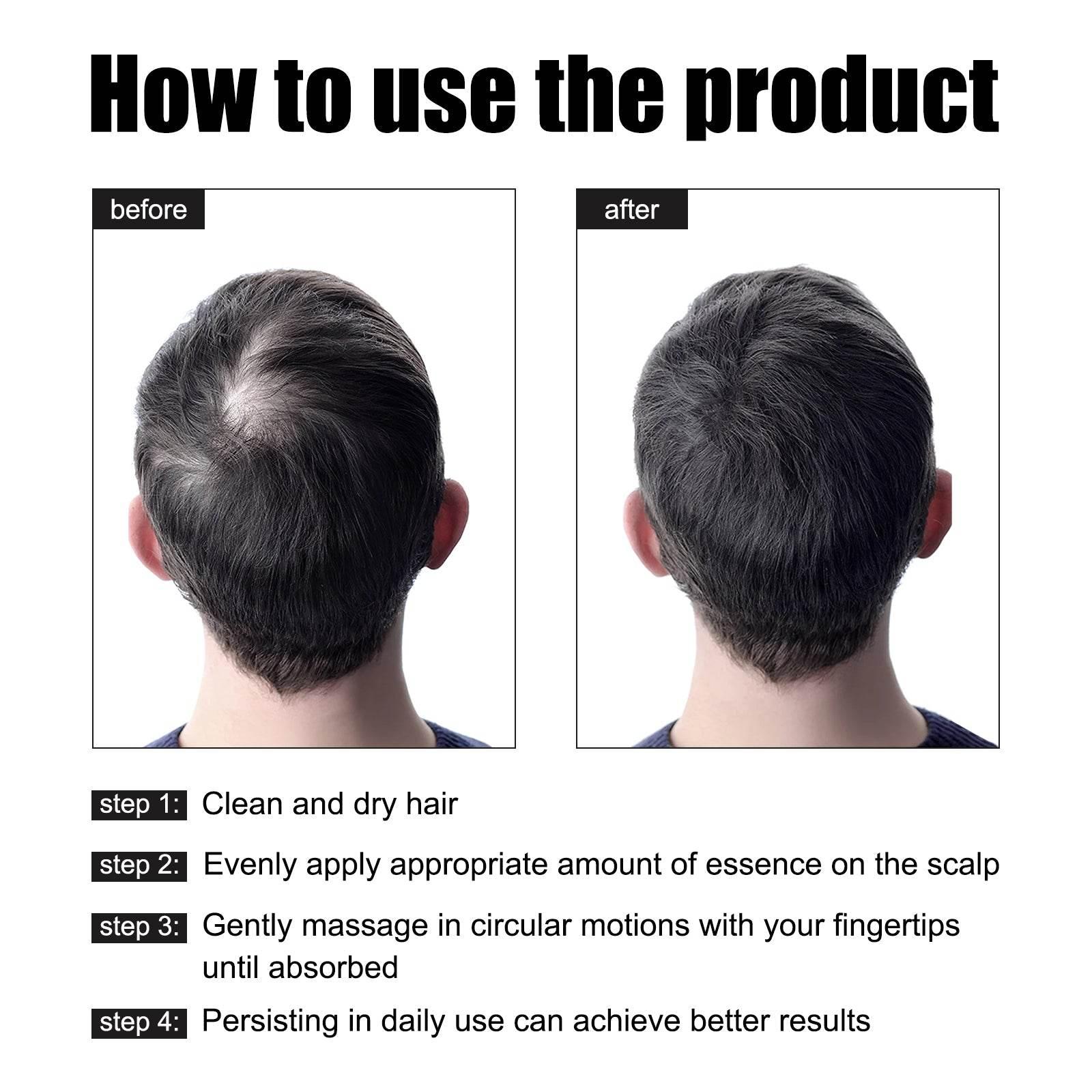 Men's Dense Hair Essence for Strengthening and Nourishing Hair - Estalios