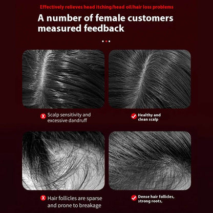 Electric Vibration Massage Comb for Hair Growth and Scalp Care - Estalios