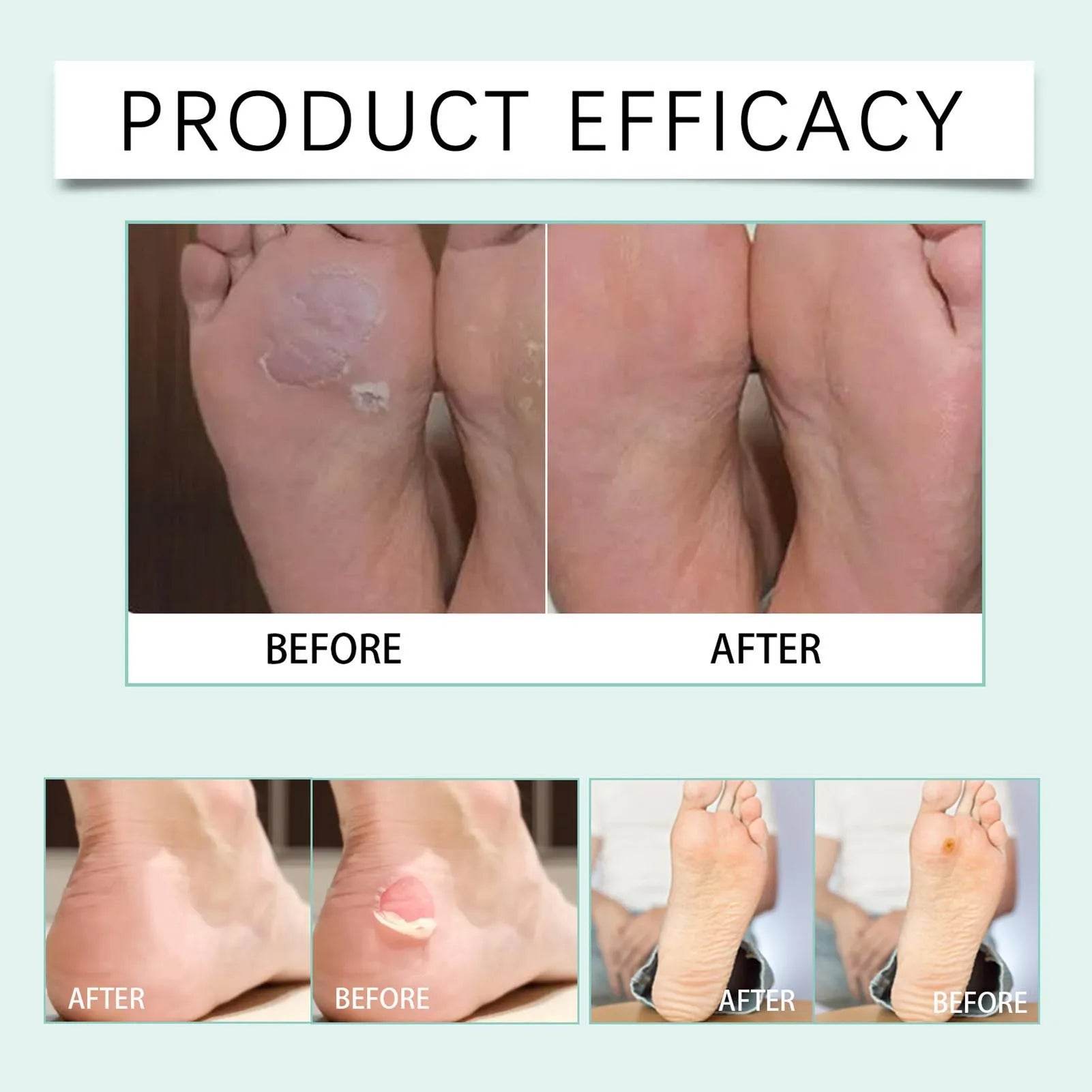 10pcs High Heels Gel Blister Bandages for Foot Protection - Estalios