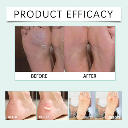 10pcs High Heels Gel Blister Bandages for Foot Protection - Estalios