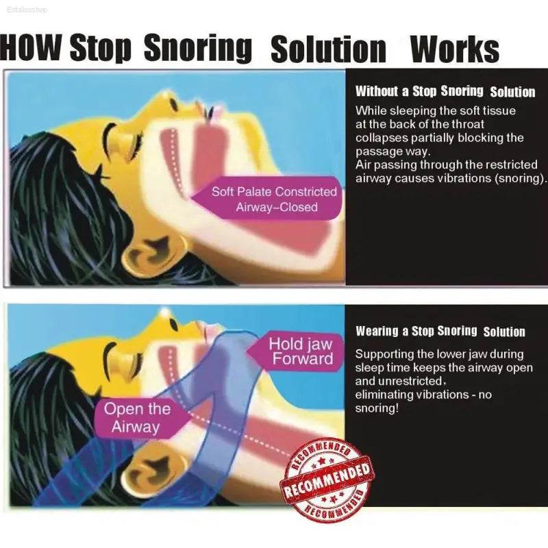 Anti Snore Aid Stop Snoring Strap Jaw Support for Sleep Apnea - Estalios